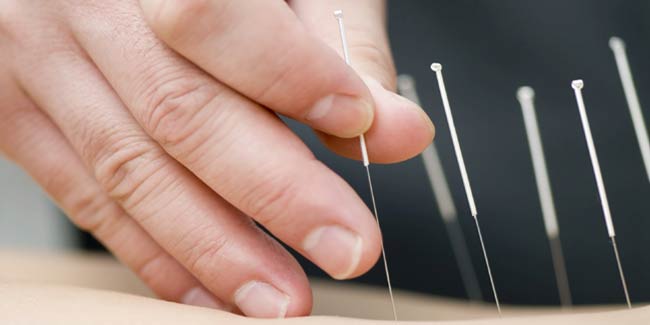 acupuncture-2-650x325